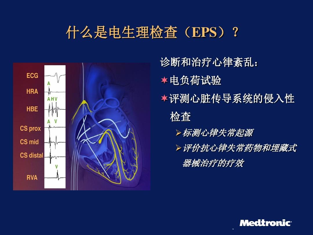 阵发性室上性心动过速的治疗_阵发性室性心动过_阵发性房动心动过速