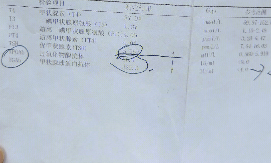 停优甲乐20天有什么症状_停服优甲后有啥反应_停优甲乐后有什么症状