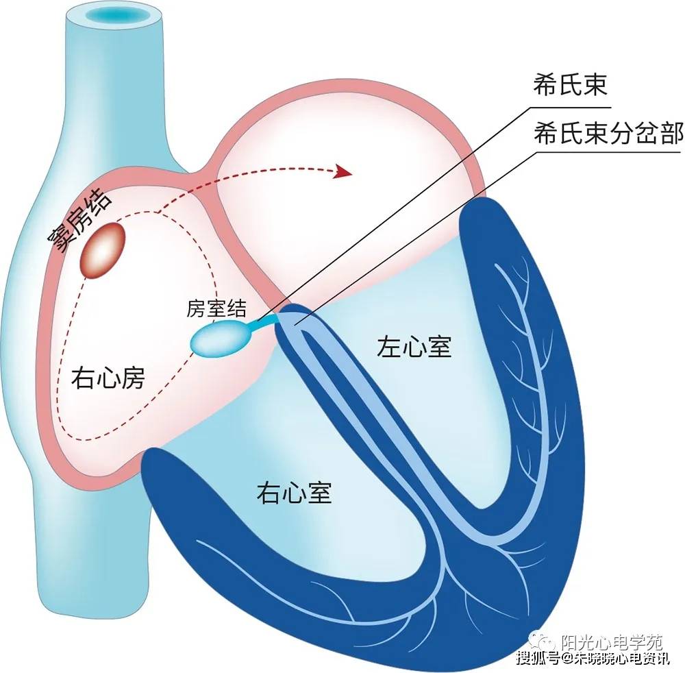 阵发性房动心动过速_阵发性房性心动_阵发性室上性心动过速/治疗