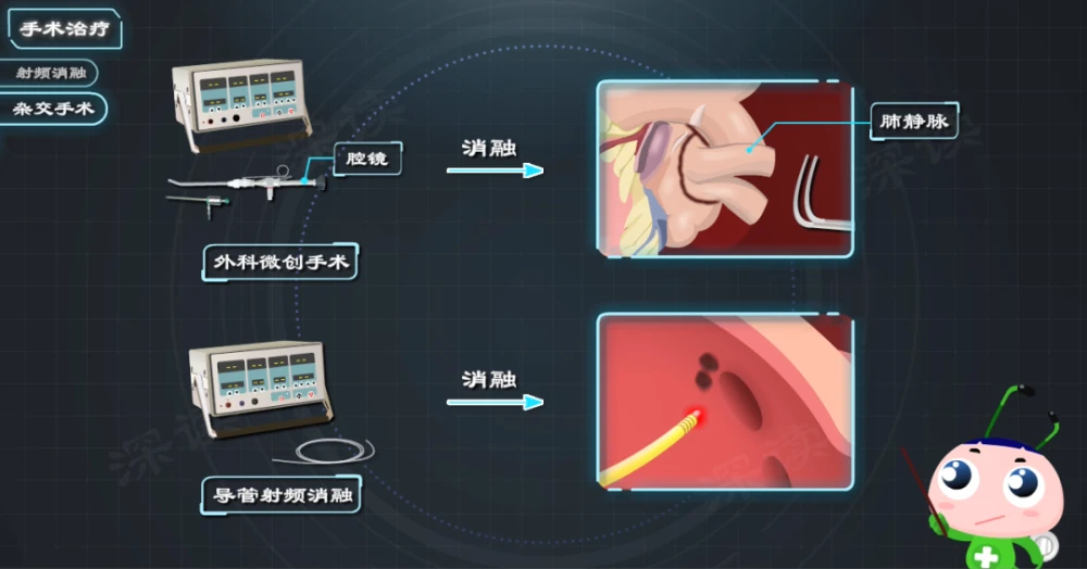 阵发性房性心动_阵发性房动心动过速_阵发性室上性心动过速/治疗