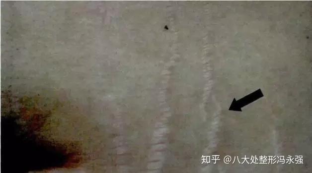 淫纹是什么_淫纹是什么_银纹是什么意思